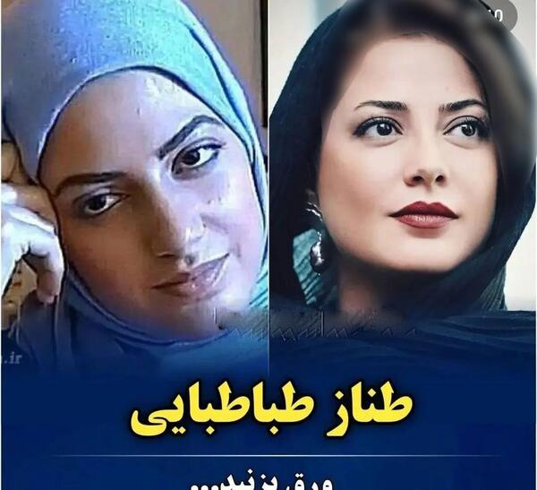 عکس بازیگران زن ایرانی قبل از عمل زیبایی