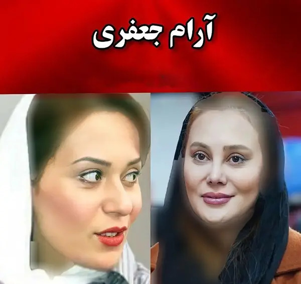 عکس بازیگران زن ایرانی قبل از عمل زیبایی
