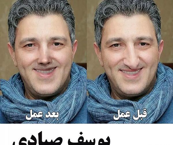 عکس بازیگران مرد ایرانی قبل از عمل زیبایی