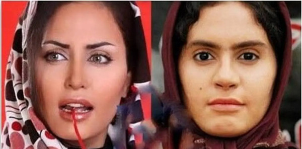 عکس بازیگران مرد ایرانی قبل از عمل زیبایی