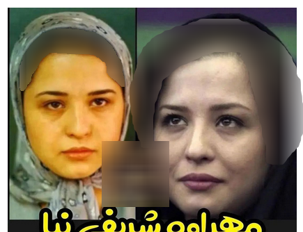 عکس بازیگران ایرانی قبل و بعد از عمل زیبایی