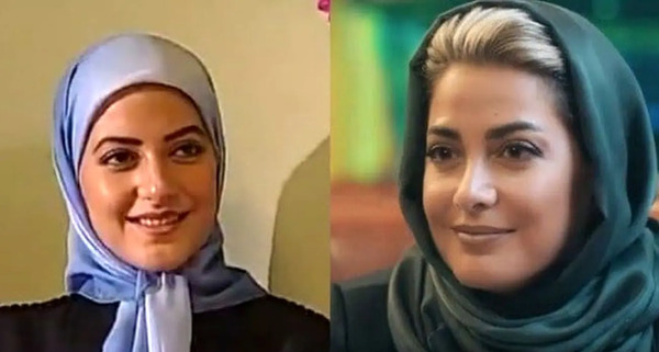 عکس بازیگران ایرانی قبل و بعد از عمل زیبایی