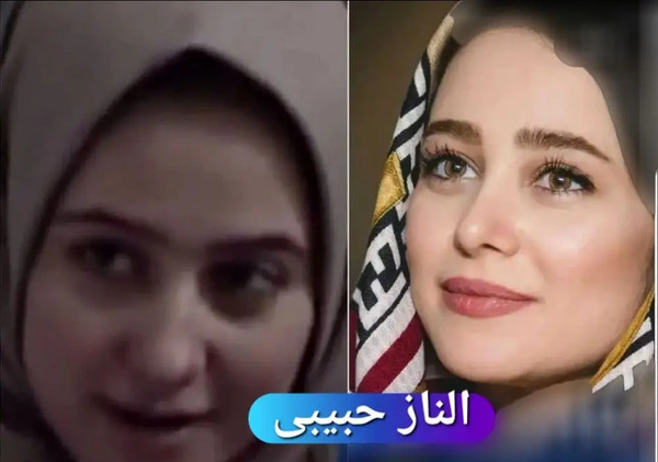 عکس بازیگران زن ایرانی قبل و بعد از عمل زیبایی