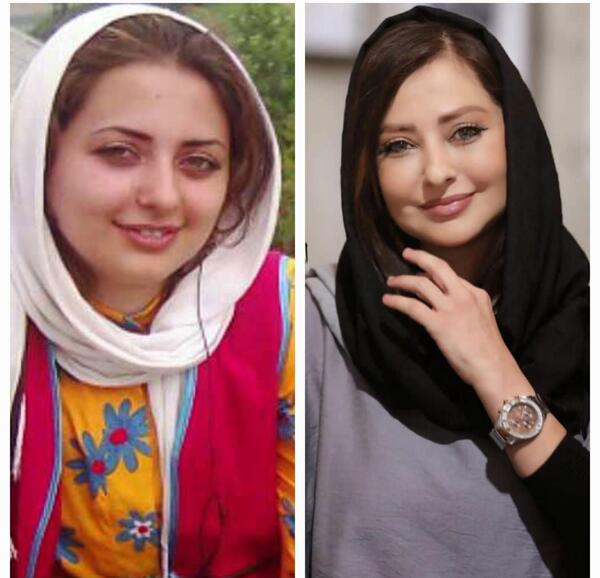 عکس بازیگران زن ایرانی قبل و بعد از عمل زیبایی
