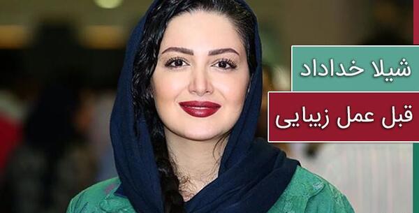 عکس بازیگران مرد ایرانی قبل و بعد از عمل زیبایی