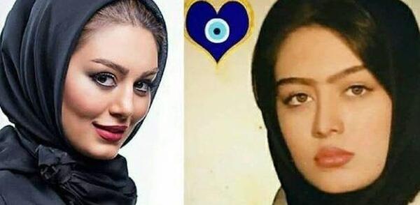 عکس های بازیگران ایرانی قبل و بعد از عمل زیبایی