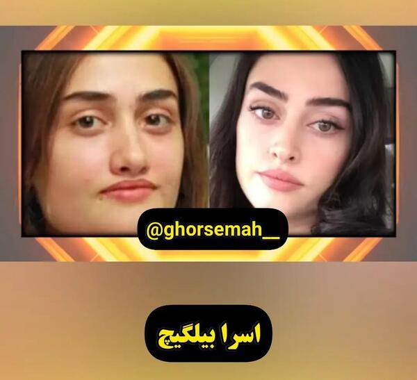 عکس بازیگران مرد ترکی قبل از عمل