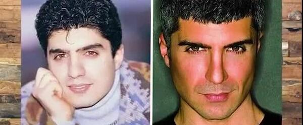 عکس بازیگران مرد ترکی قبل از عمل