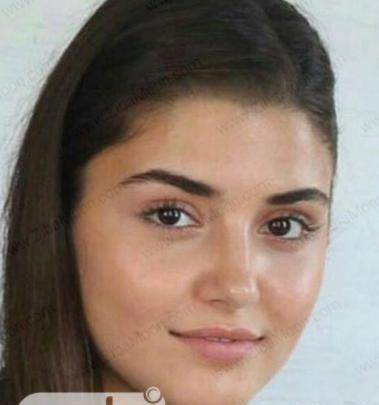 عکس های بازیگران ترکی قبل از عمل