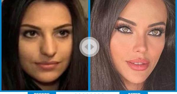 عکس های بازیگران ترکی قبل از عمل