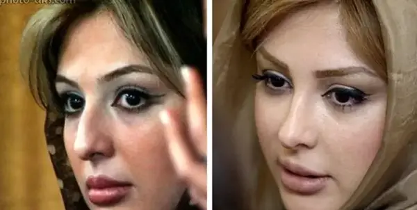 عکس های بازیگران ترکی قبل از عمل