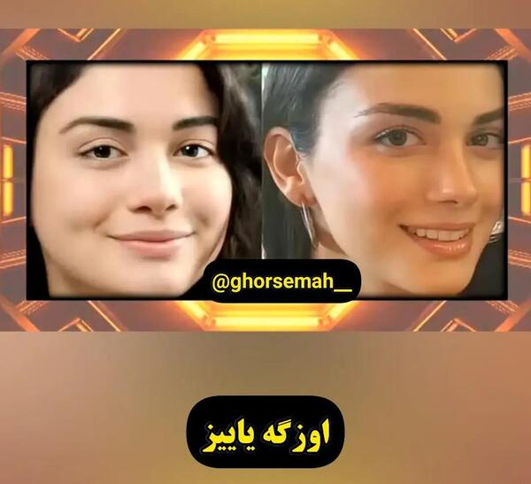 عکس های بازیگران ترکی قبل از عمل