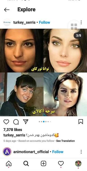 عکس بازیگران ترکی قبل عمل