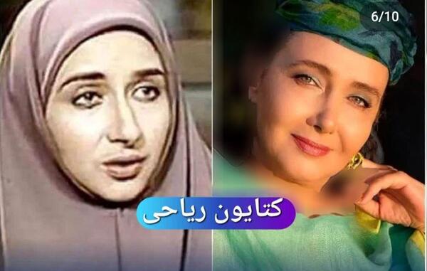 عکس بازیگران قبل از عمل بینی
