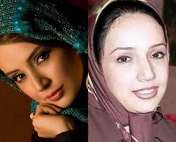 عکس بازیگران قبل از عمل بینی