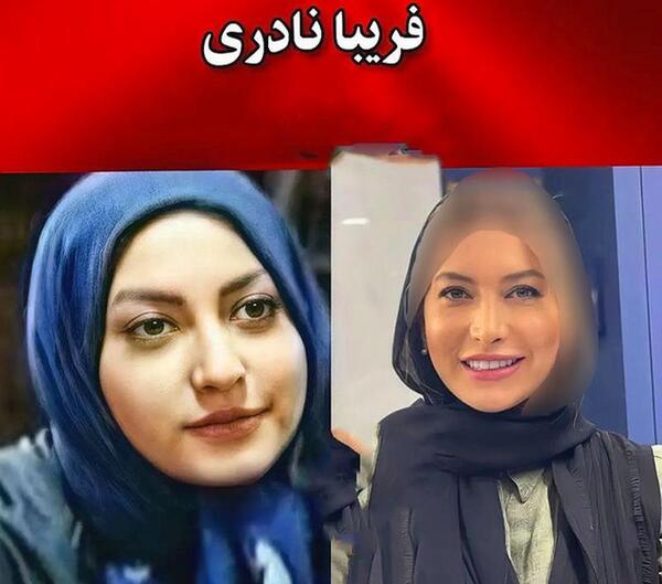 عکس بازیگران قبل از عمل بینی
