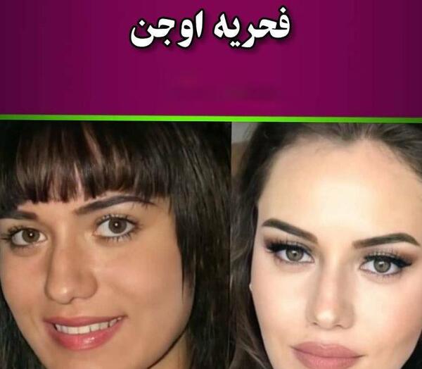 عکس بازیگران قبل از عمل زیبایی
