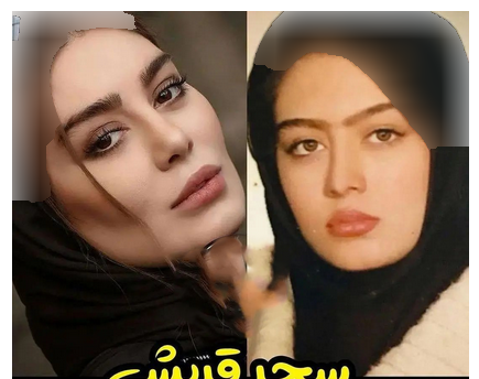 عکس بازیگران قبل از عمل زیبایی