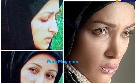 عکس بازیگران قبل از عمل زیبایی