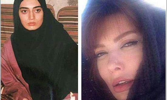 عکس بازیگران قبل از عمل زیبایی
