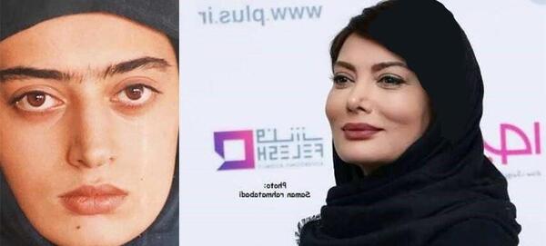 عکس بازیگران قبل از عمل زیبایی