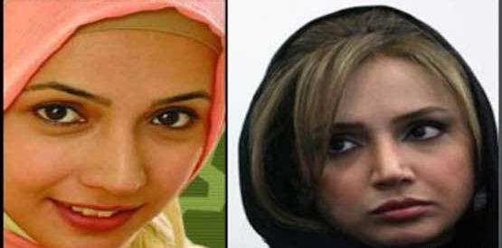 عکس بازیگران قبل از عمل زیبایی