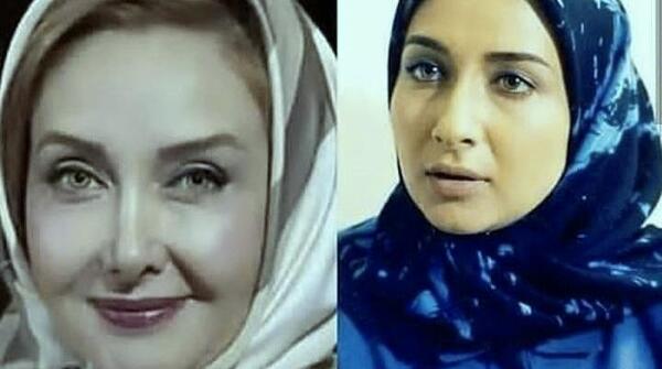 عکس بازیگران قبل و بعد از عمل زیبایی