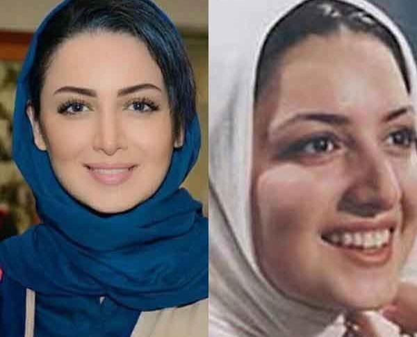 عکس بازیگران قبل و بعد از عمل زیبایی