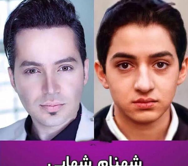عکس بازیگران قبل و بعد از عمل زیبایی