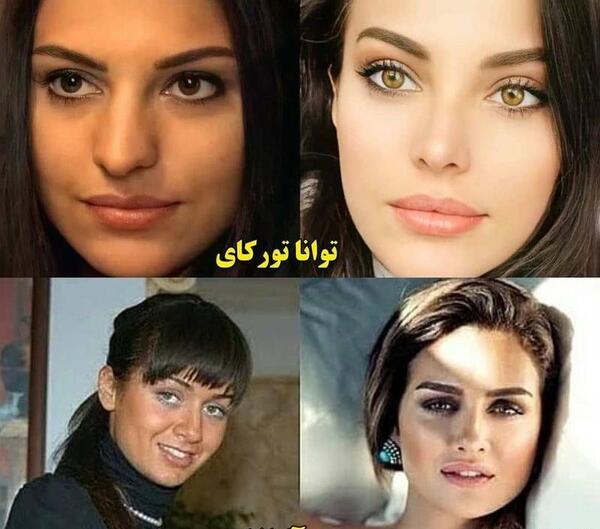عکس بازیگران ترک قبل از عمل