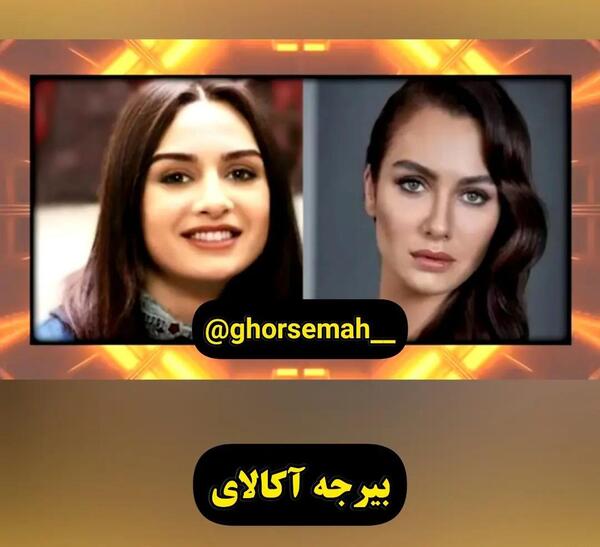 عکس بازیگران ترک قبل از عمل