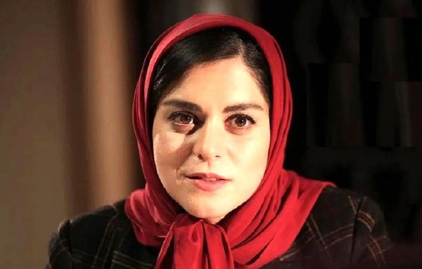 عکس الهام اخوان قبل از عمل زیبایی