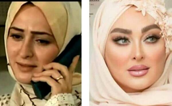 عکس الهام اخوان قبل از عمل زیبایی