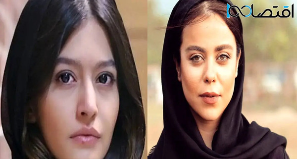 عکس الهام اخوان قبل از عمل زیبایی