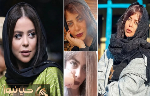 عکس الهام اخوان قبل از عمل زیبایی