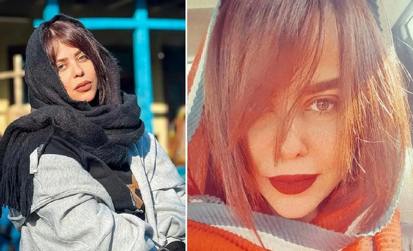 عکس الهام اخوان قبل از عمل