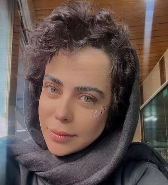 عکس الهام اخوان قبل از عمل
