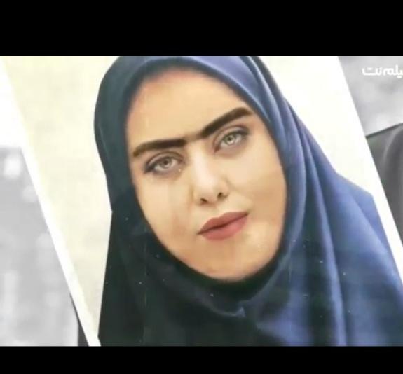 عکس الهام اخوان قبل از عمل