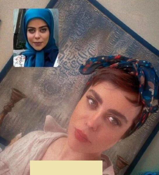 عکس الهام اخوان قبل از عمل