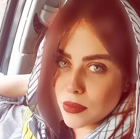 عکس الهام اخوان قبل از عمل