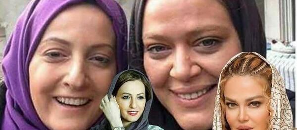 عکس بازیگران زن قبل از عمل زیبایی