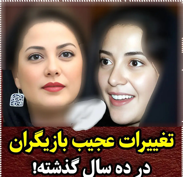 عکس بازیگران زن قبل از عمل زیبایی