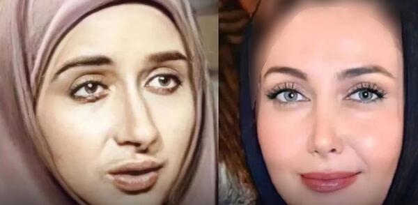 عکس بازیگران زن قبل از عمل زیبایی