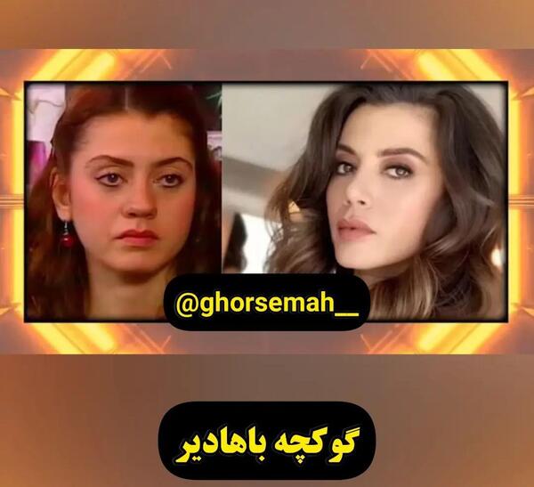 عکس بازیگران ترکی قبل و بعد از عمل