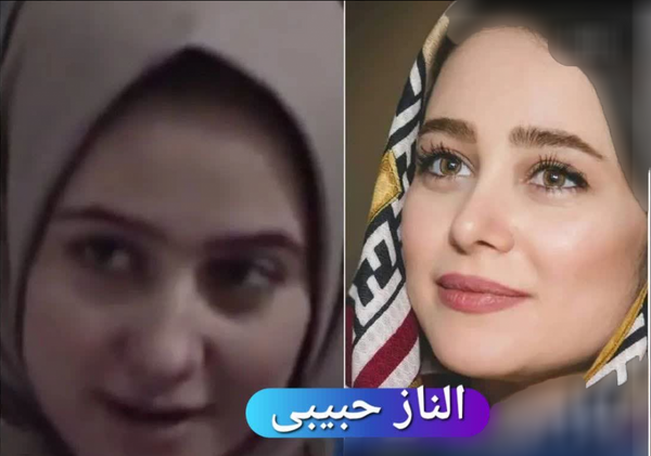 عکس بازیگران زن ایرانی قبل و بعد عمل زیبایی