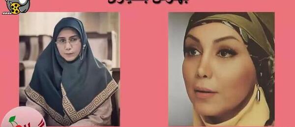 عکس بازیگران زن ایرانی قبل و بعد عمل زیبایی