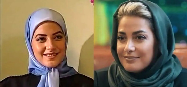 عکس بازیگران زن ایرانی قبل و بعد عمل زیبایی