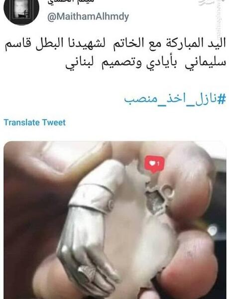 عکس دست قطع شده سردار سلیمانی