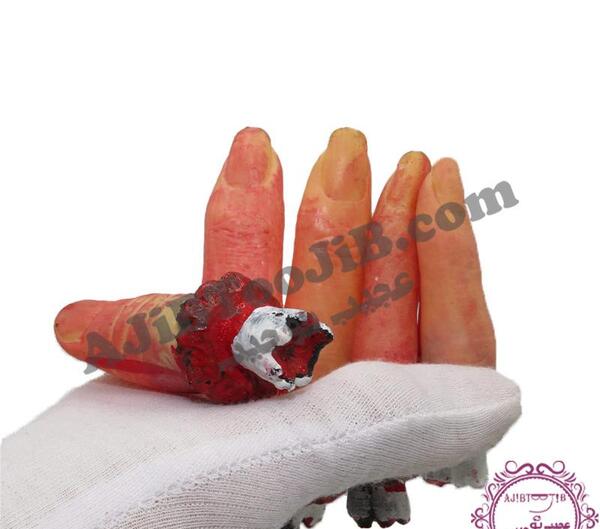 عکس دست قطع شده در چهارشنبه سوری