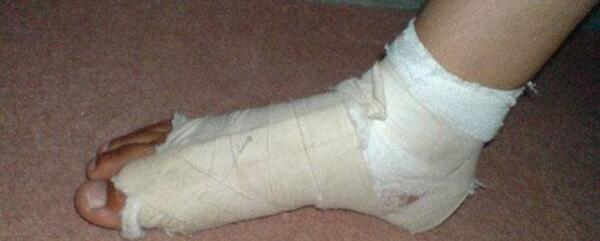 عکس دسته شکسته فیک